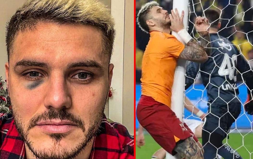 ¡Impactante video! El terrible accidente de Mauro Icardi que preocupó a Wanda Nara