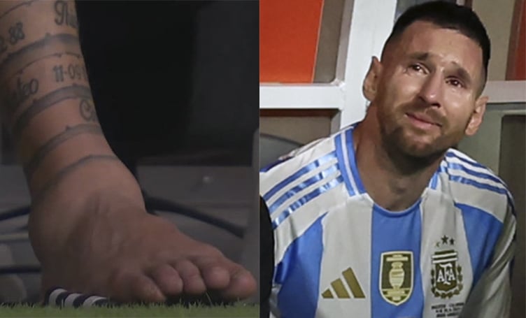 ¡Impactante video! La escalofriante lesión de Messi en la final de la Copa América