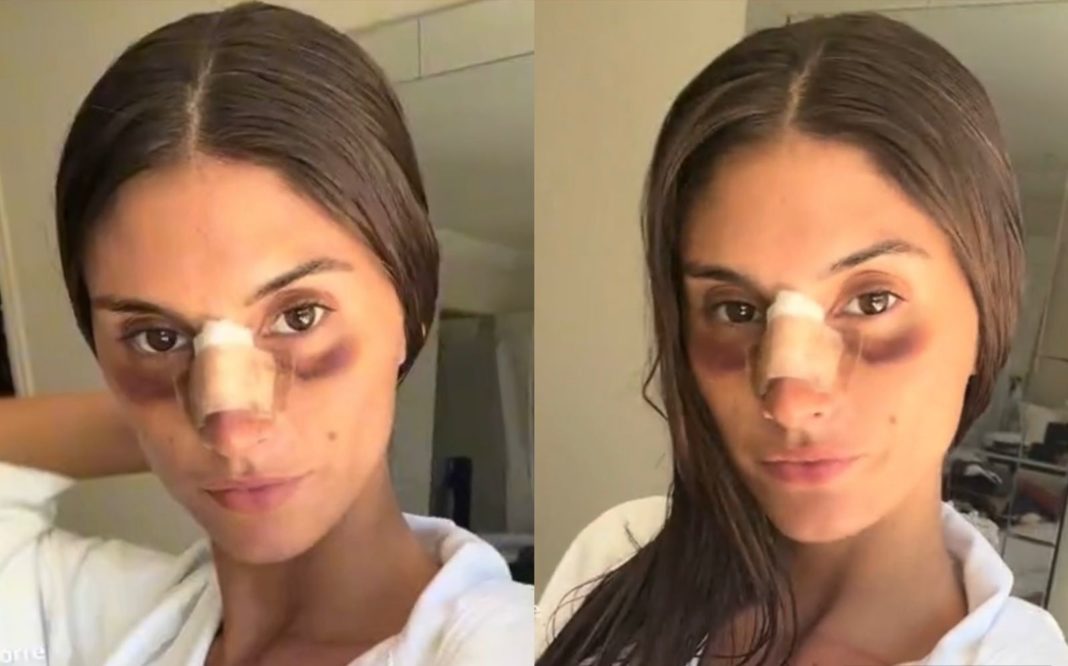 La Transformación de Lola Latorre: Más Allá de la Cirugía Estética